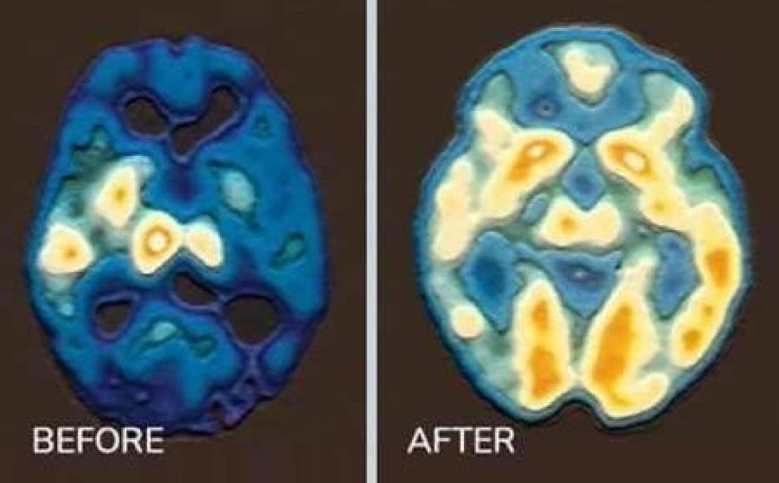brain-1