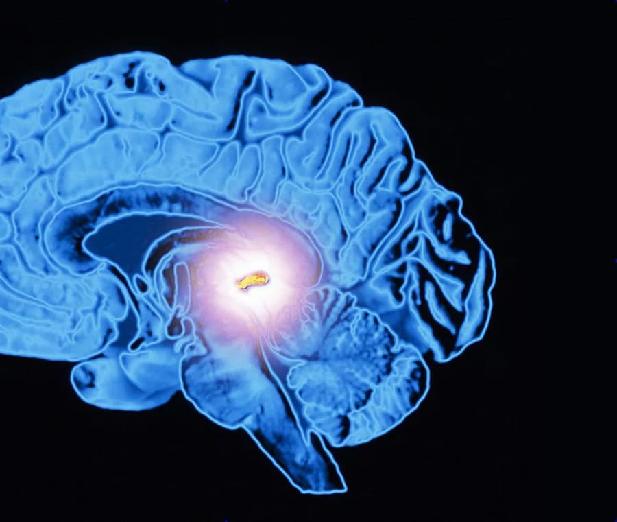 pineal-gland